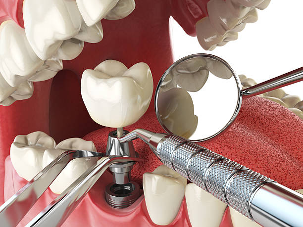 Best Emergency Orthodontic Repairs in Toppenish, WA